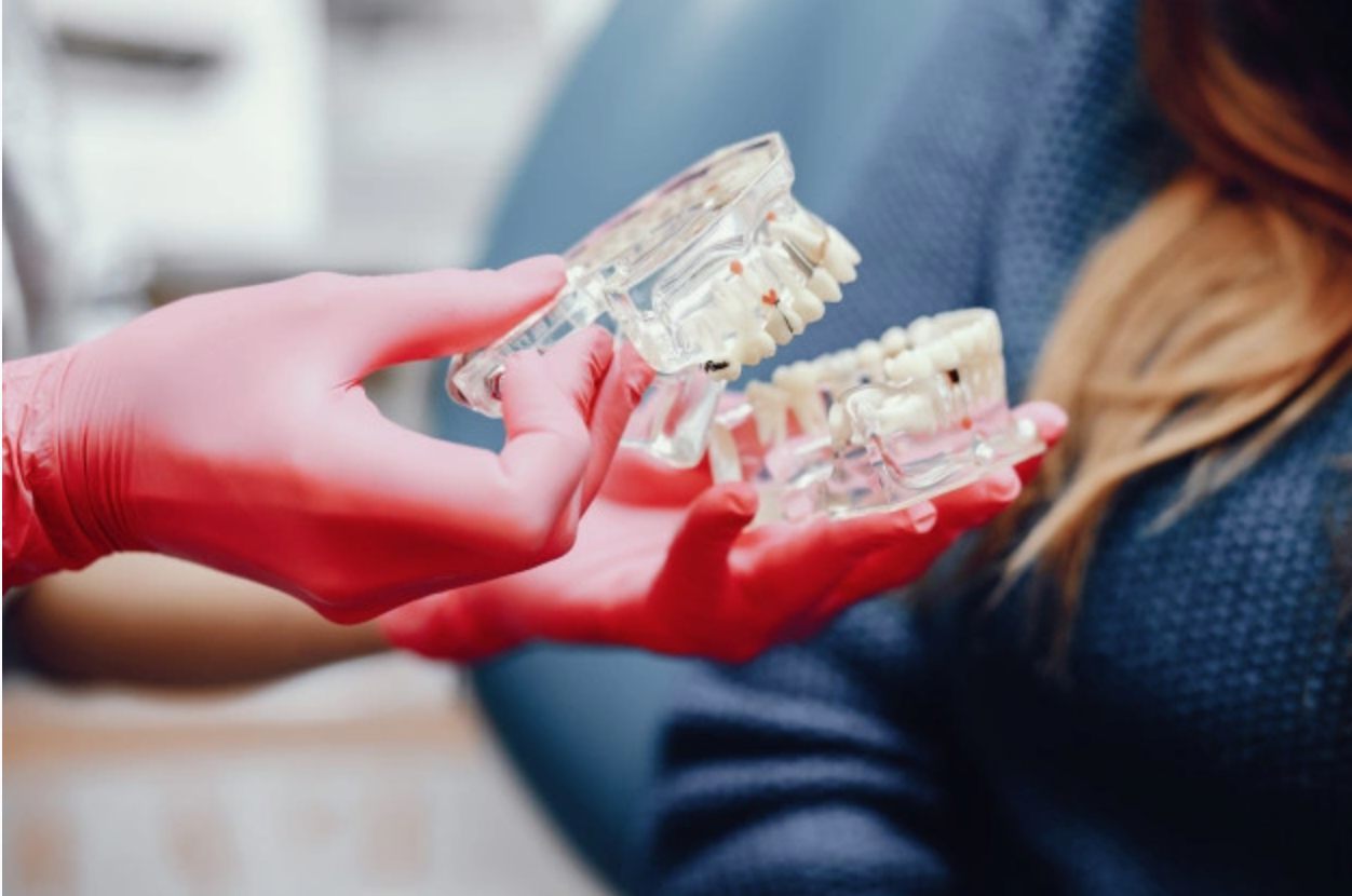 Dental professional holding an upper and lower denture model